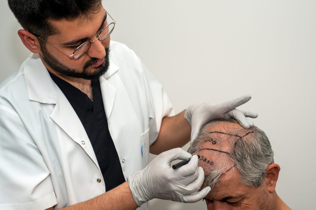 hair transplant cost in turkey